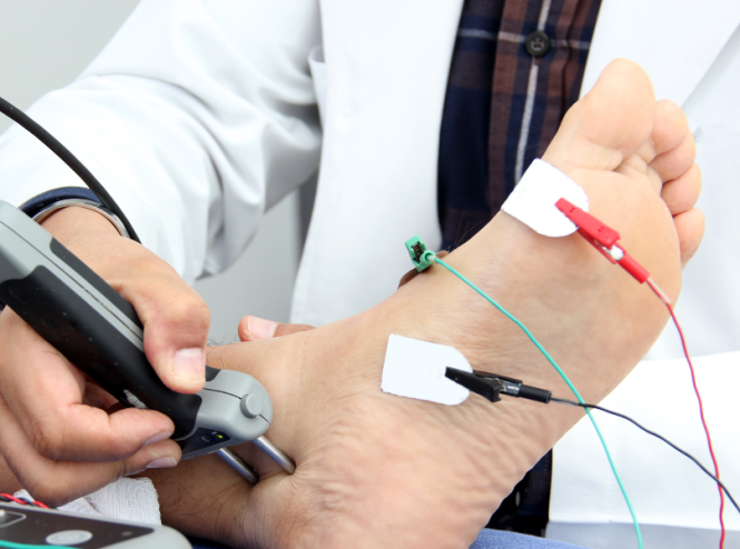 رسم العصب و العضلات