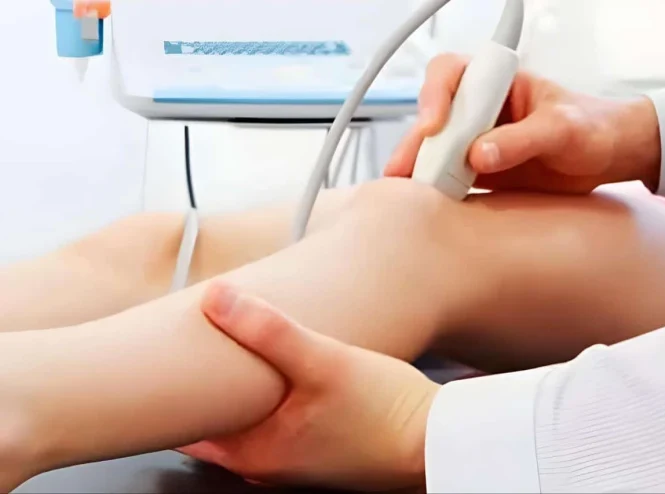 فحوصات الدوبلر